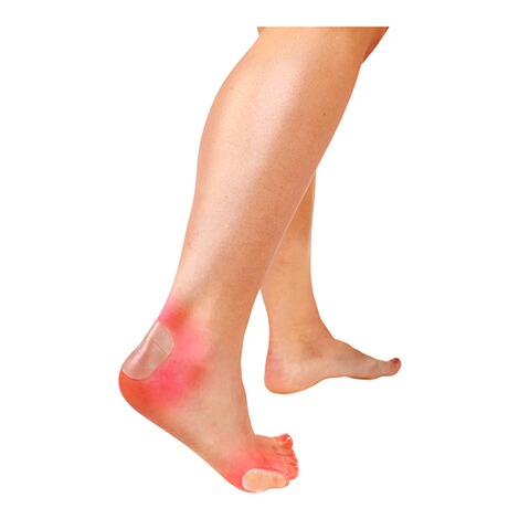 Vital Comfort  Wond- en blarenpleister 2